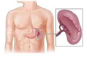 παθολογία του σπλήνα ως αιτία πόνου κάτω από την αριστερή ωμοπλάτη